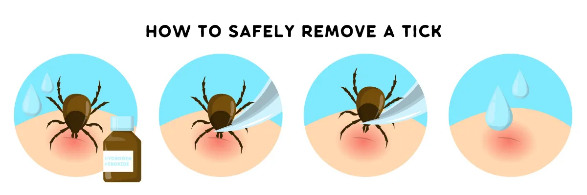 How to safely remove a tick